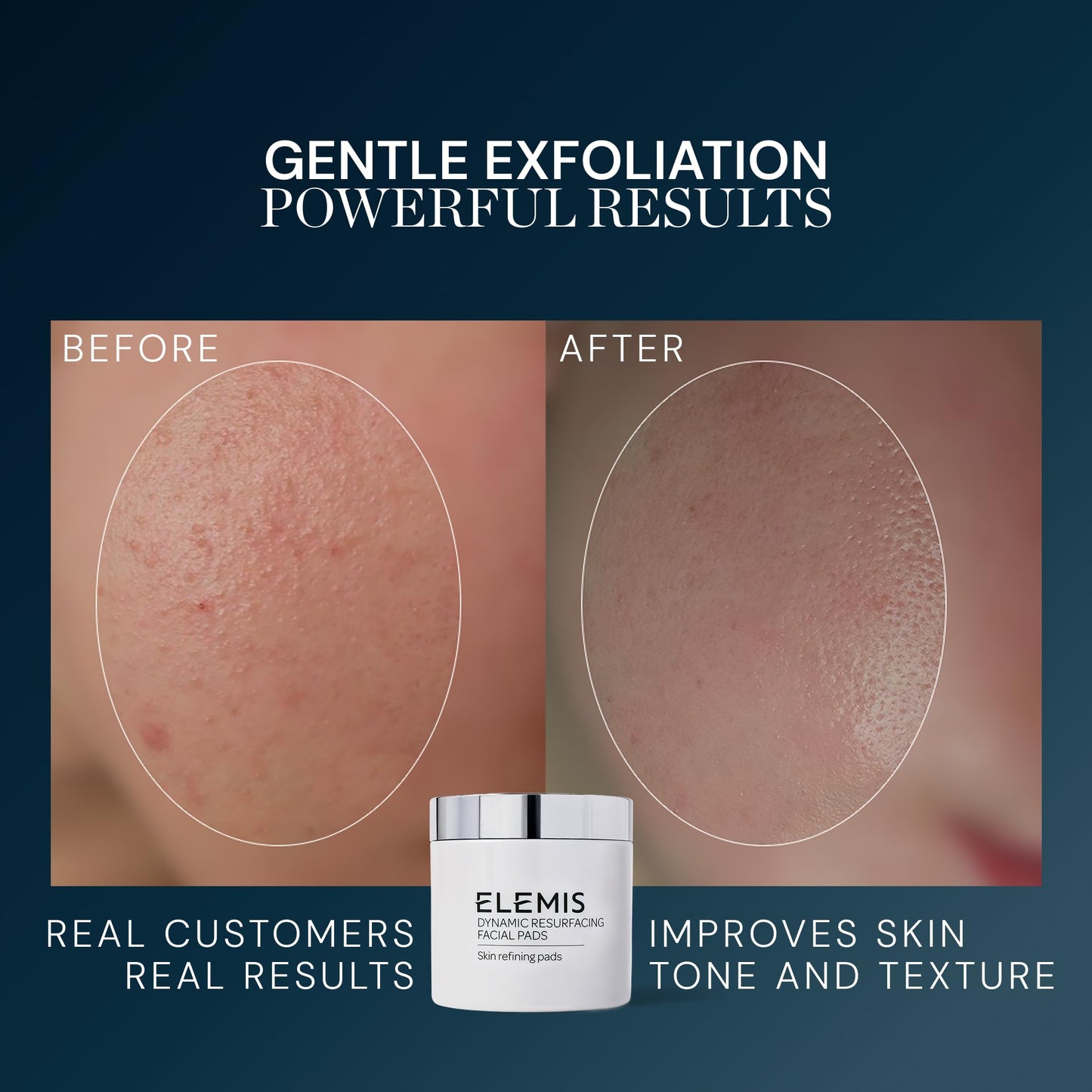 Elemis Dynamic Resurfacing Pads (60 Pads)