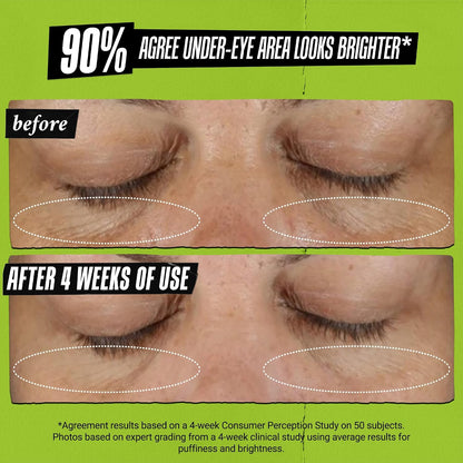Kiehl's Avocado Eye Treatment, Under Eye Cream (0.5 fl.oz)