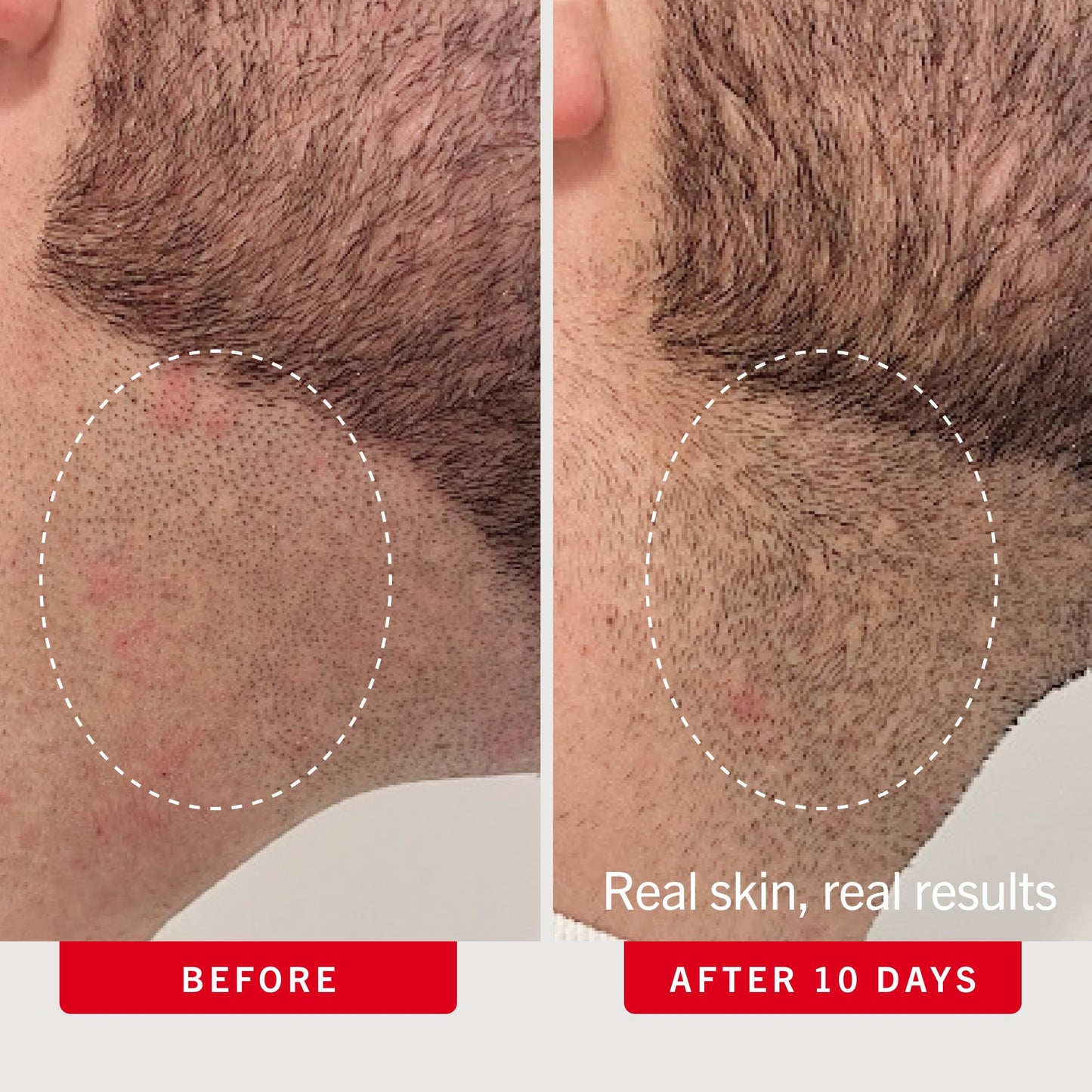 First Aid Beauty Smoothing Body Pads