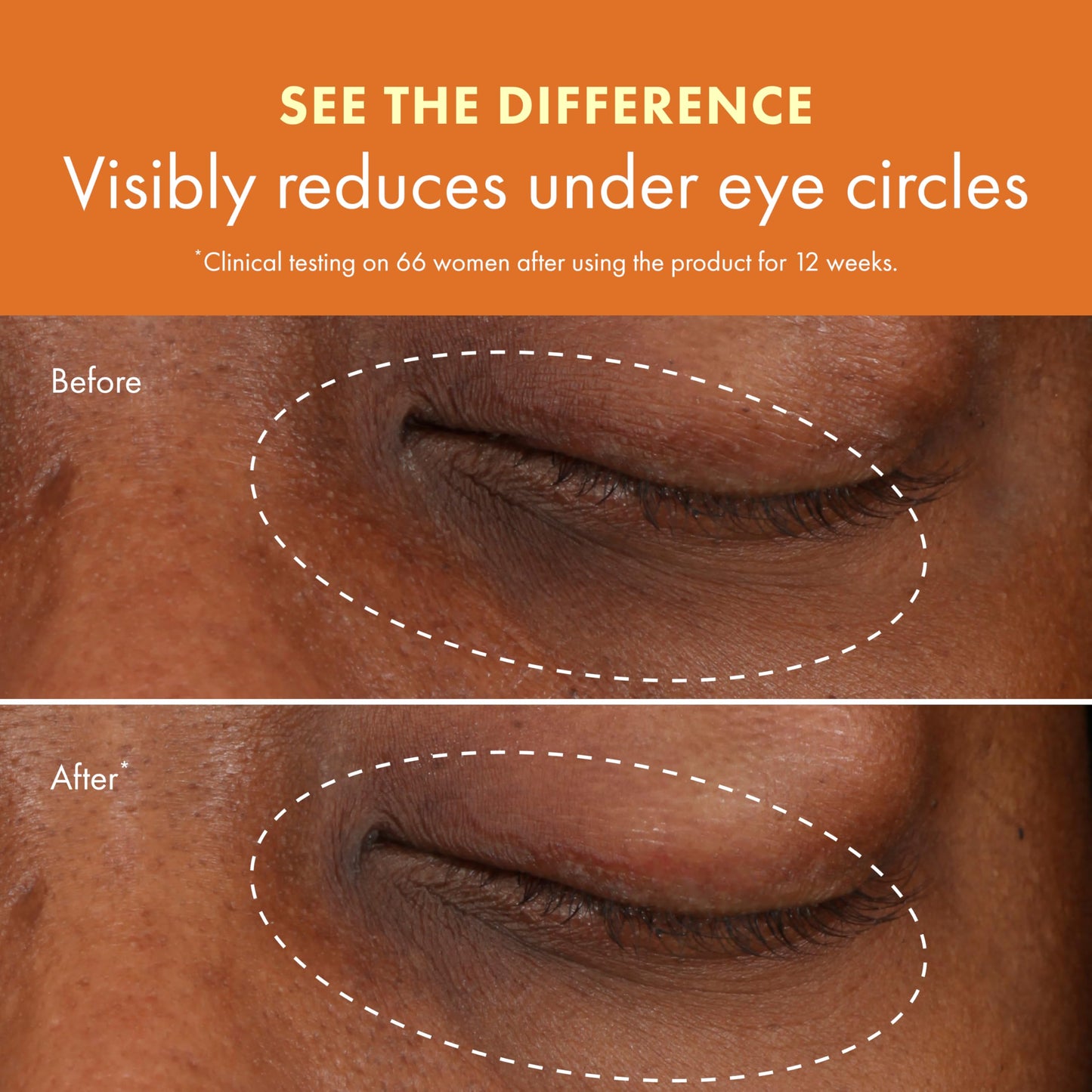 Origins GinZing Brightening Eye Cream with Vitamin C (0.5 Fl Oz)