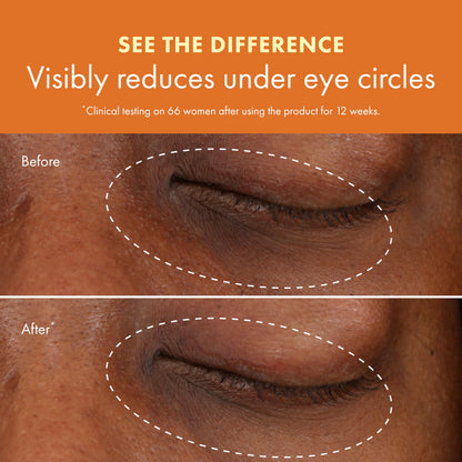 Origins GinZing Brightening Eye Cream with Vitamin C (0.5 Fl Oz)