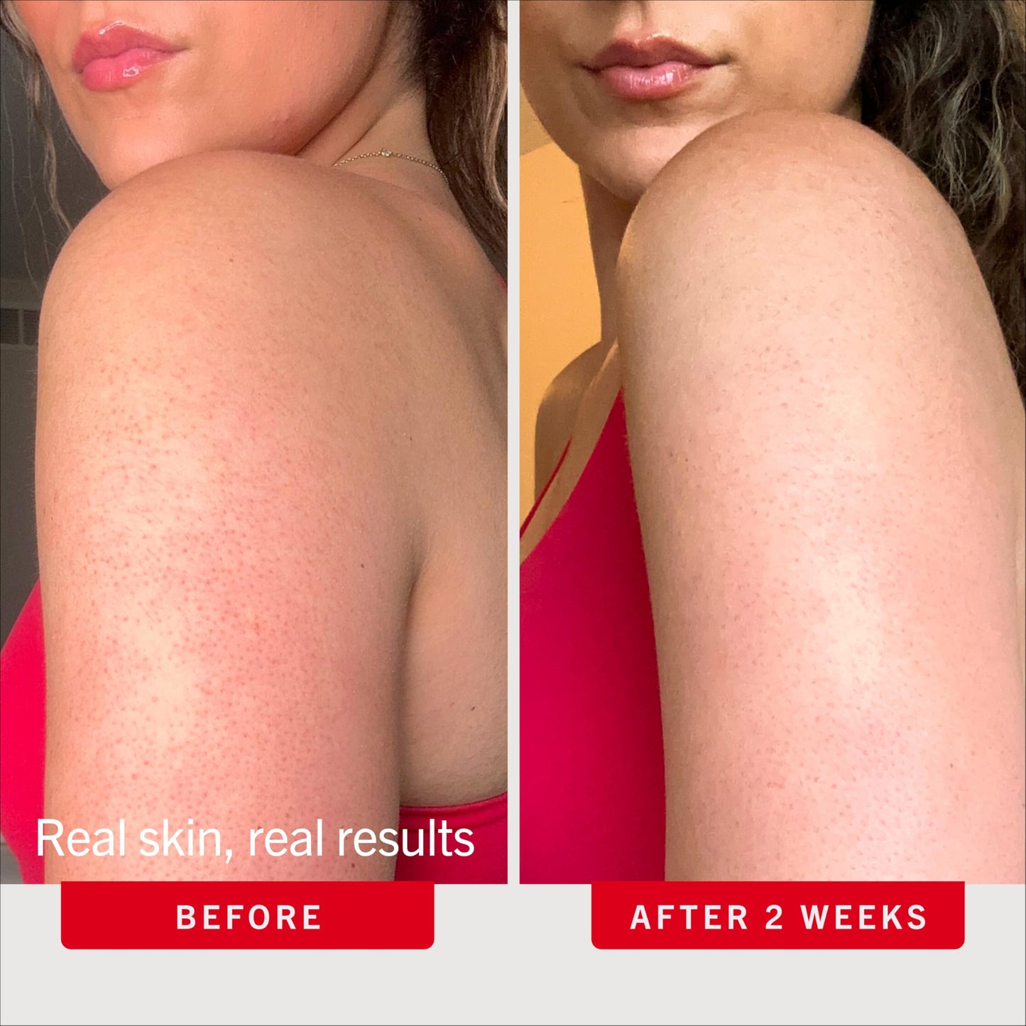First Aid Beauty Exfoliating Body Scrub