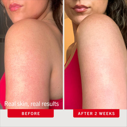 First Aid Beauty Exfoliating Body Scrub