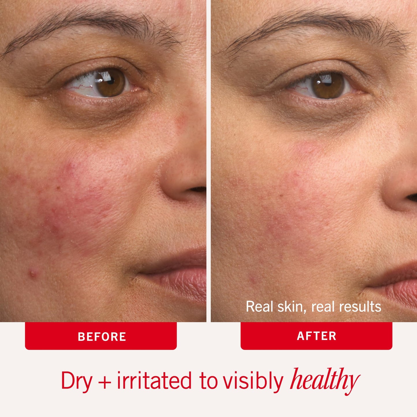 First Aid Beauty Ultra Repair Cream Intense Hydration