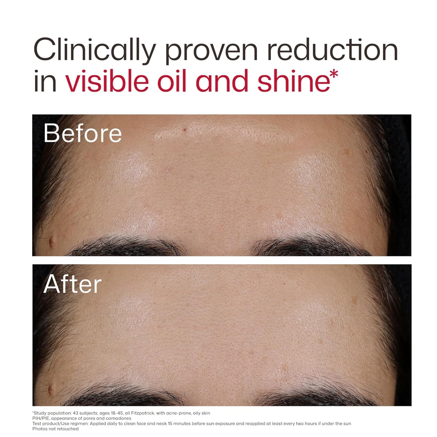 EltaMD UV Clear road-Spectrum SPF 50 Blemish-Prone & Oil Balancing (1.7 oz)
