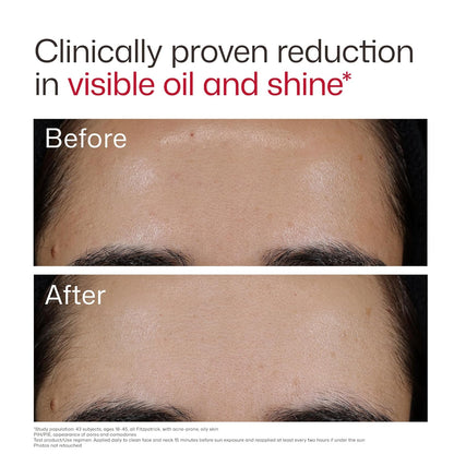EltaMD UV Clear road-Spectrum SPF 50 Blemish-Prone & Oil Balancing (1.7 oz)