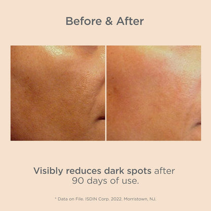 Before and after skin comparison showing dark spot reduction with text on a beige background.
