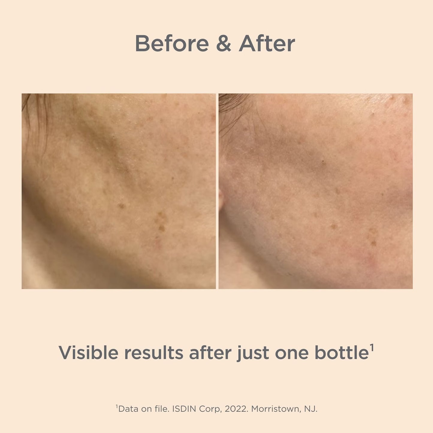 Before and after comparison of skin treatment showing visible results on a beige background.