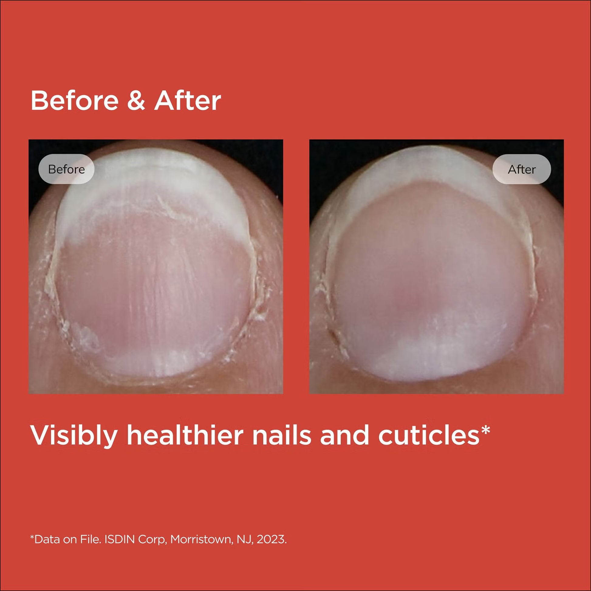 Before and after comparison of nails with visible health improvement on a red background.
