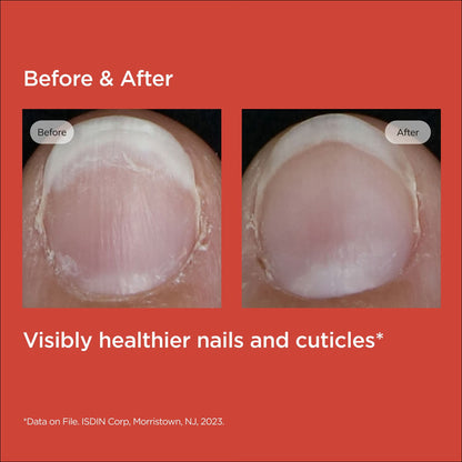 Before and after comparison of nails with visible health improvement on a red background.