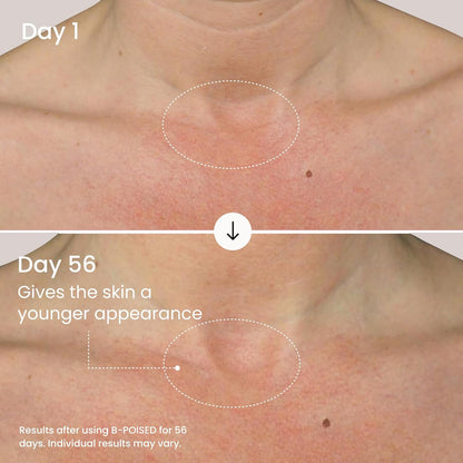MAELYS B-POISED Neck Firming Cream