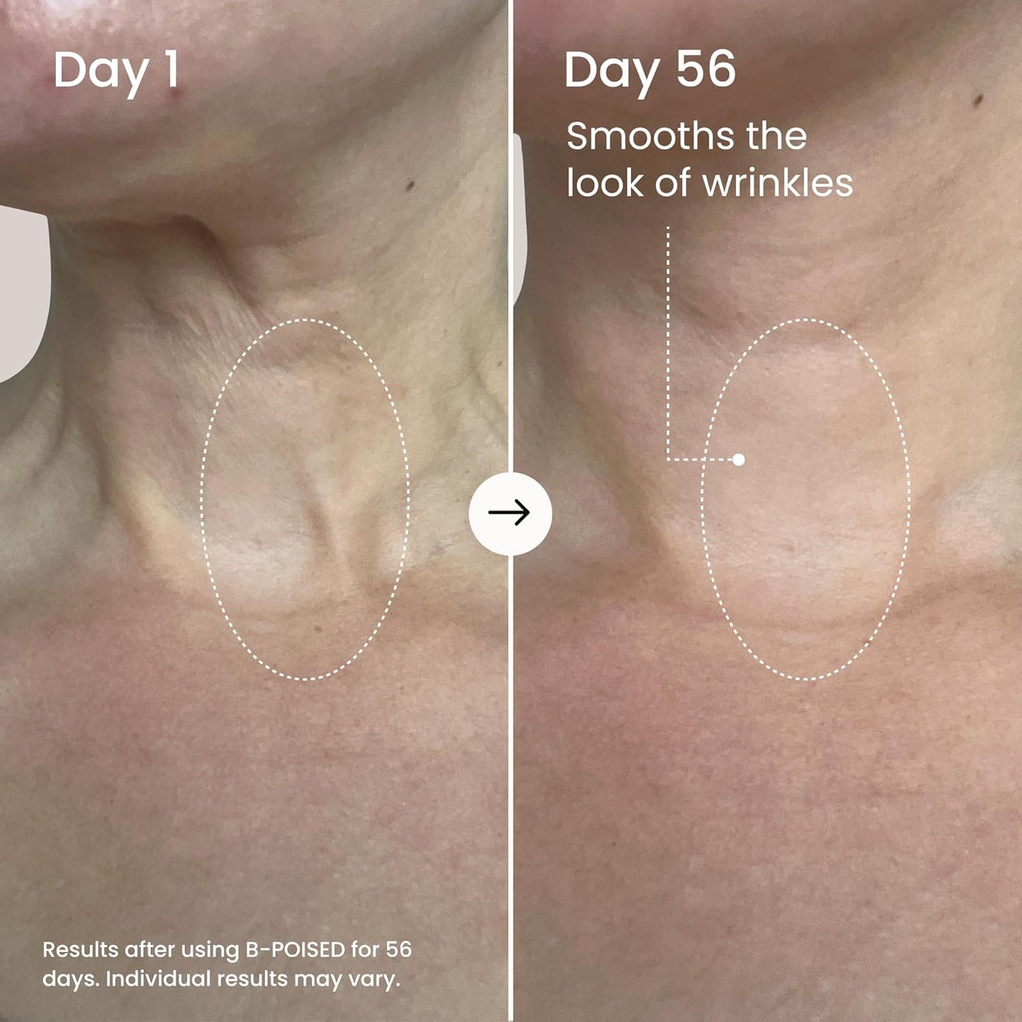 MAELYS B-POISED Neck Firming Cream
