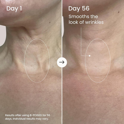 MAELYS B-POISED Neck Firming Cream