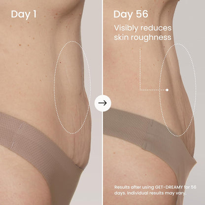 Before and after comparison of skin texture on a person's arm, showing reduced roughness after 56 days.