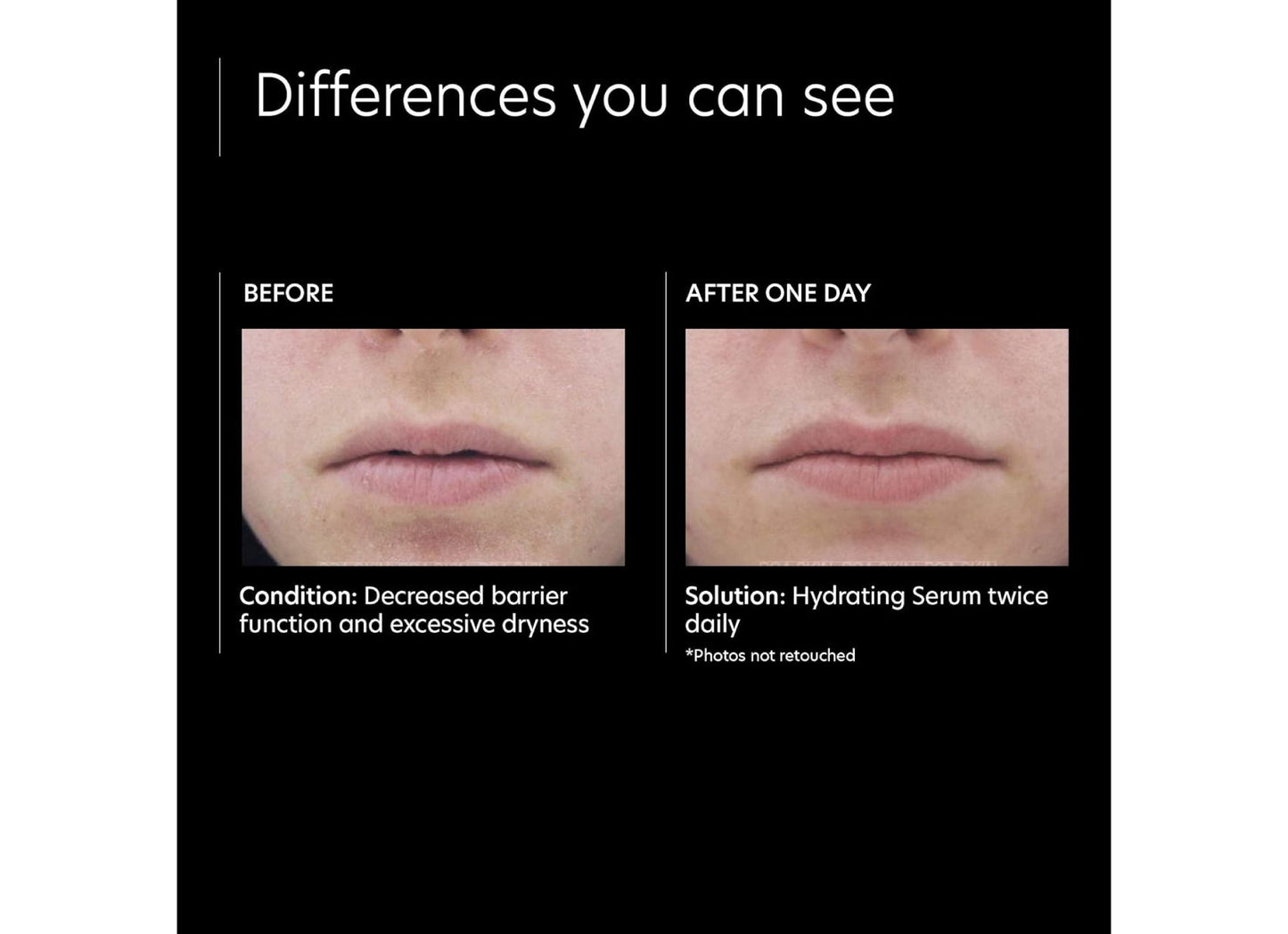 Before and after comparison of skin condition with a hydrating serum solution.