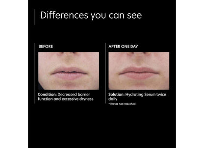 Before and after comparison of skin condition with a hydrating serum solution.