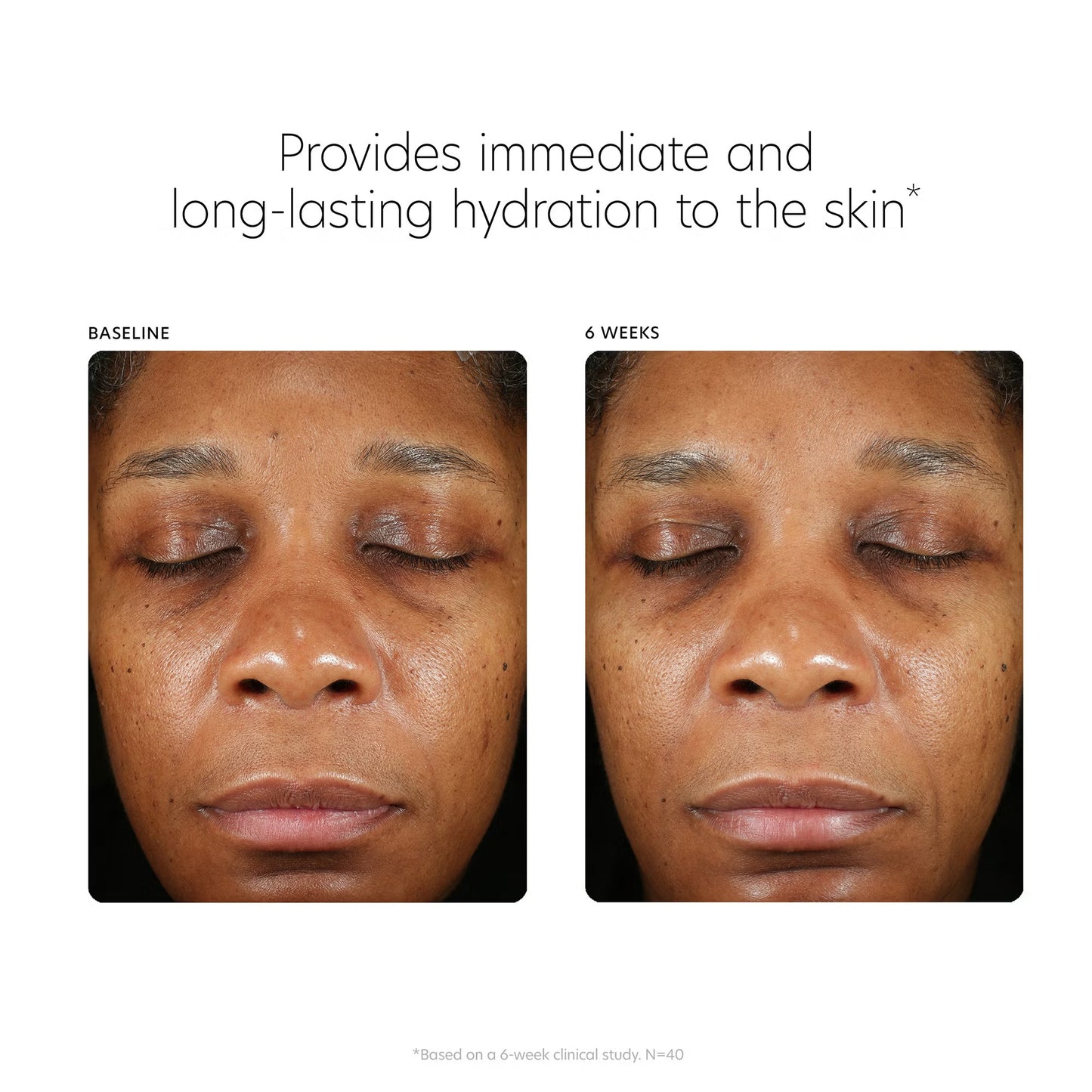 Before and after comparison of skin hydration with text indicating immediate and long-lasting hydration benefits.