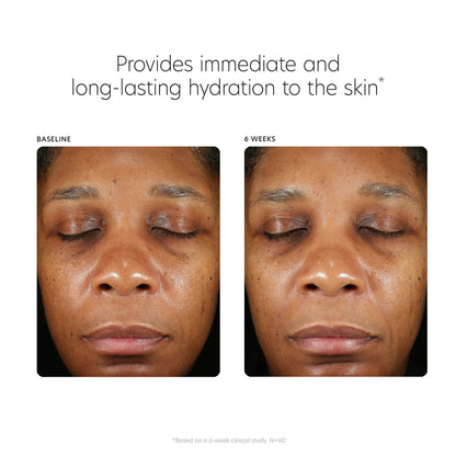 Before and after comparison of skin hydration with text indicating immediate and long-lasting hydration benefits.